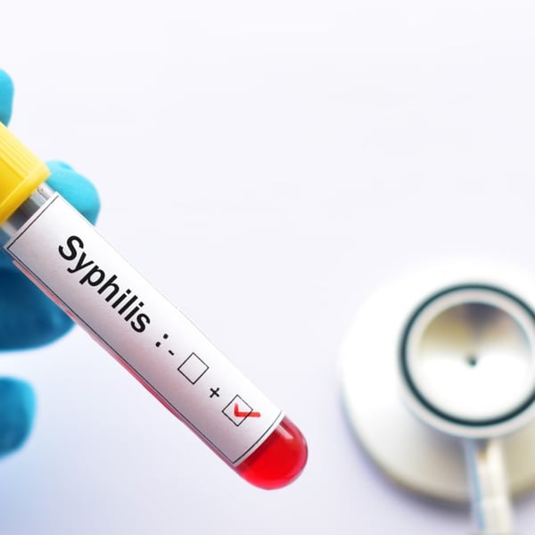 Sexual health group wants urgent improvement in South Auckland syphilis care