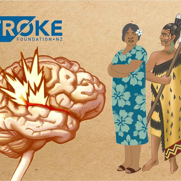 Calls for government to fund a stroke programme designed to benefit Pasifika and Māori communities